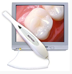 Intraoral Camera at Surprise Oral & Implant Surgery in Surprise, AZ